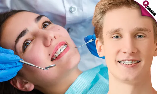 Metal Dental Braces!